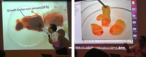講演：台湾陽明大学歯科系血液再生臨床応用講座　　蘇 正堯　先生