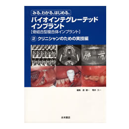 バイオインテグレーテッドインプラント