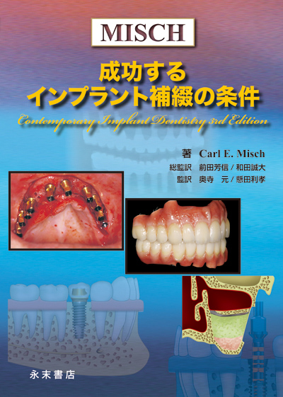成功するインプラント補綴の条件